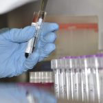 CORONAVIRUS (2)