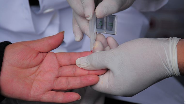 Diabetes, mucho más que azúcar alta Diabetes, mucho más que azúcar alta