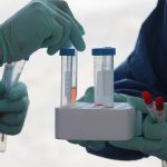 CORONAVIRUS (PRUEBAS) (2)